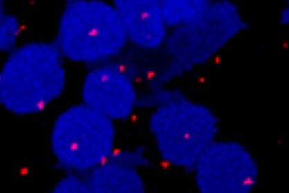 Lab image showing kidney cancer as blue circles and red dots representing the HIF-2 complex