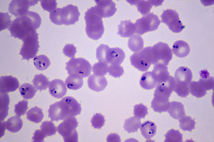 Purple microscopic dots
