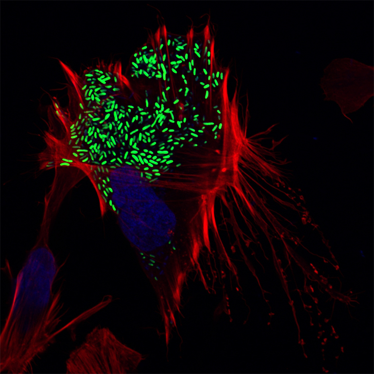 Red and green Vibrio parahaemolyticus bacteria