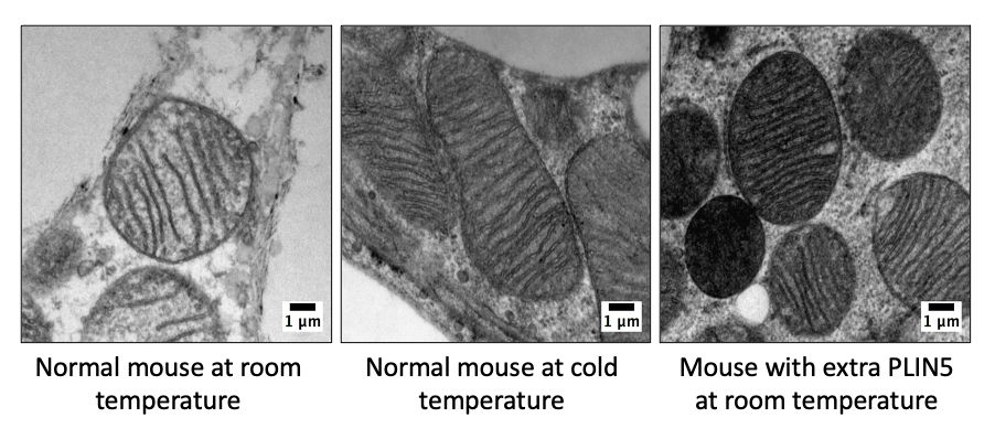 mitochondria in brown fat cells