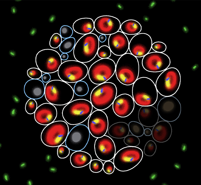 Above are fluorescent images of genetically identical yeast cells, marked for some of the biomarkers that UT Southwestern researchers discovered help to predict cell fate. 