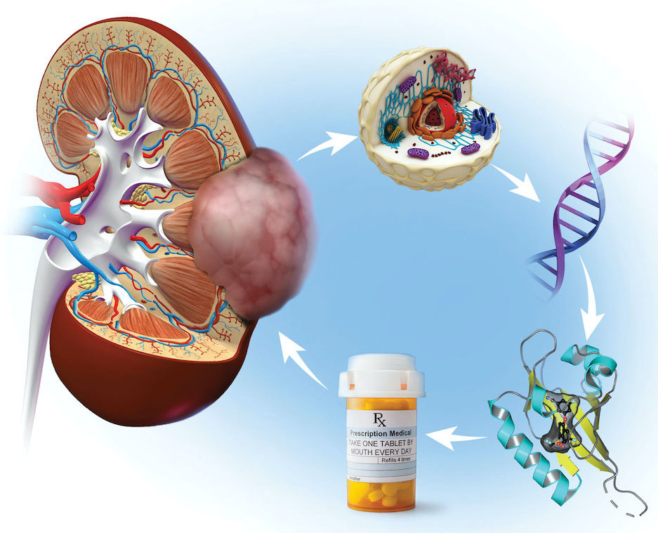 FDA approval of belzutifan culminates 25-year journey at UTSW from gene discovery to a first-in-class drug