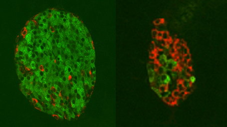 Beta cells