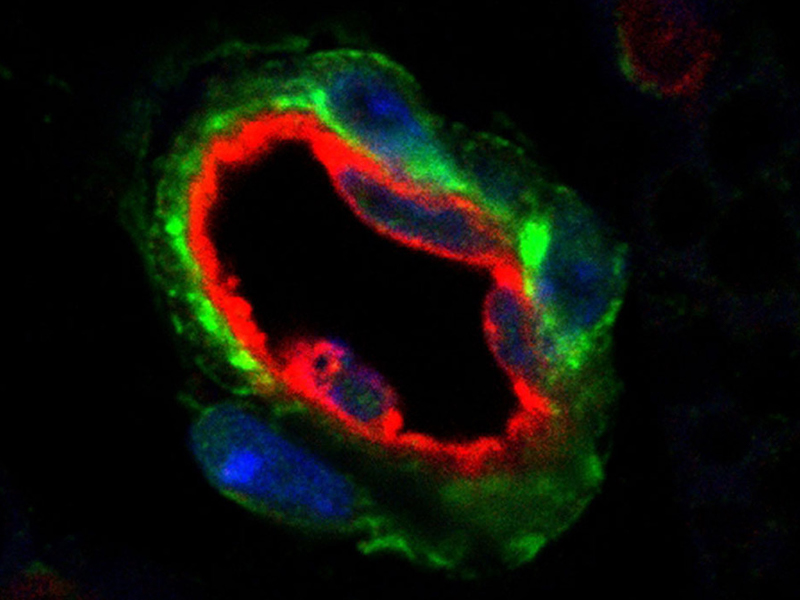  An image showing a blood vessel in fat tissue, surrounded by fat progenitor cells (in green).