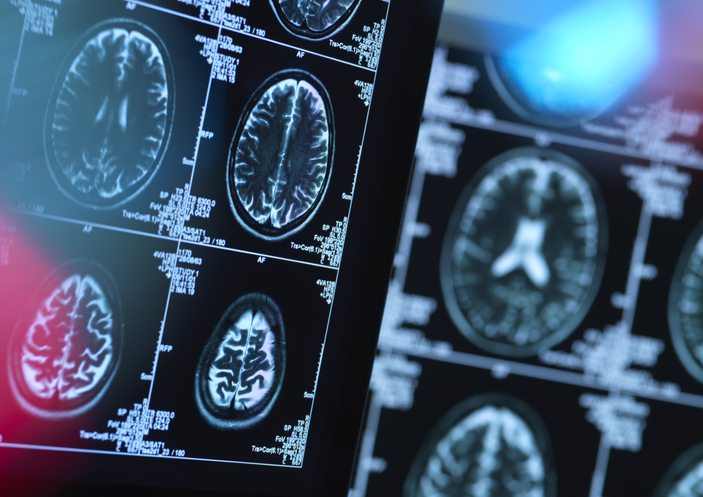 Brain imaging is one of the many features that help in the diagnosis of immune-mediated brain conditions.