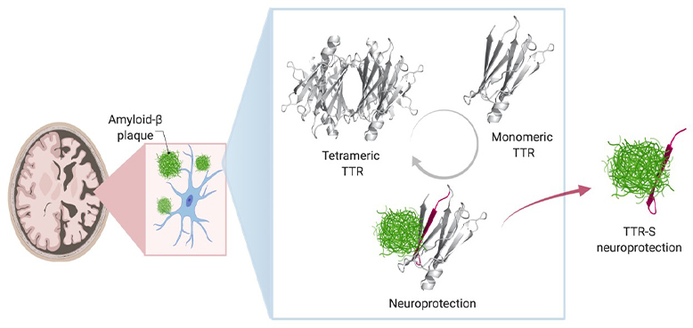 Abnormal deposits of the protein amyloid beta in the brain