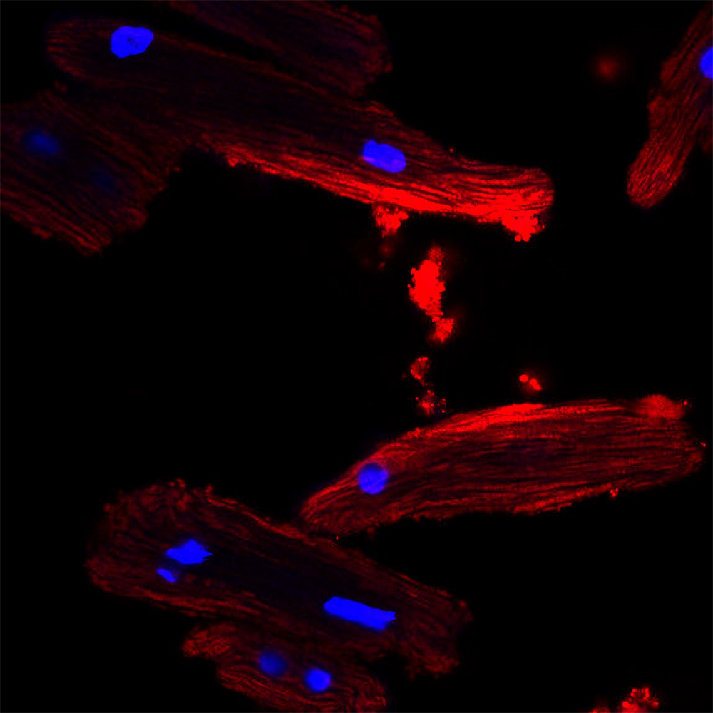 Heart cells that have taken up red colored fat cell-derived extracellular vesicles.