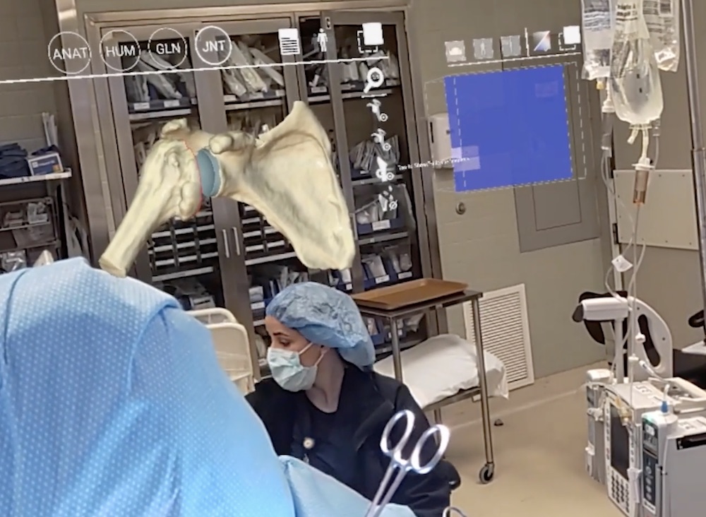 The use of an augmented reality surgical plan results in the highest level of precision surgery.