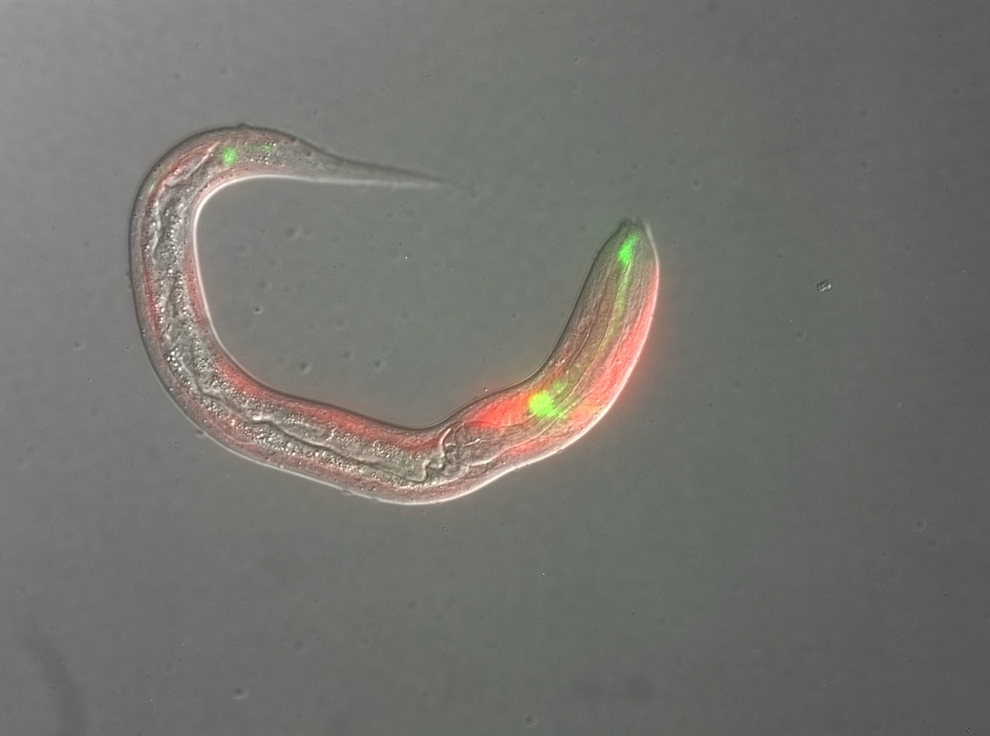 Photo of Micrograph of a Strongyloides stercoralis parasite larva that expresses fluorescent markers showing the worm's cytoskeleton (red) and sensory neurons in the head and tail (green). 