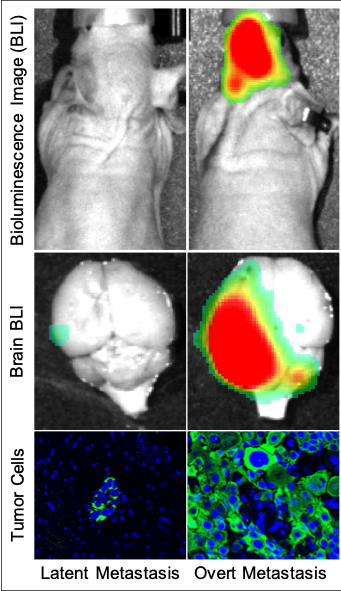 Bioluminescent images of mice with latent and overt brain metastasis