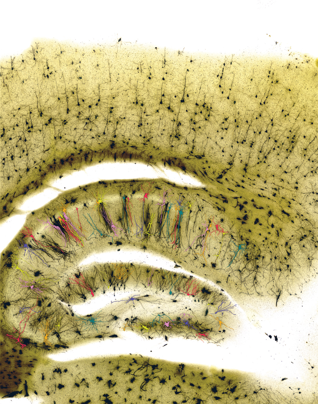 A mouse brain using a brightfield microscope