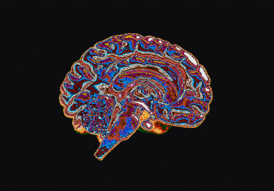 Cross-Section of Brain