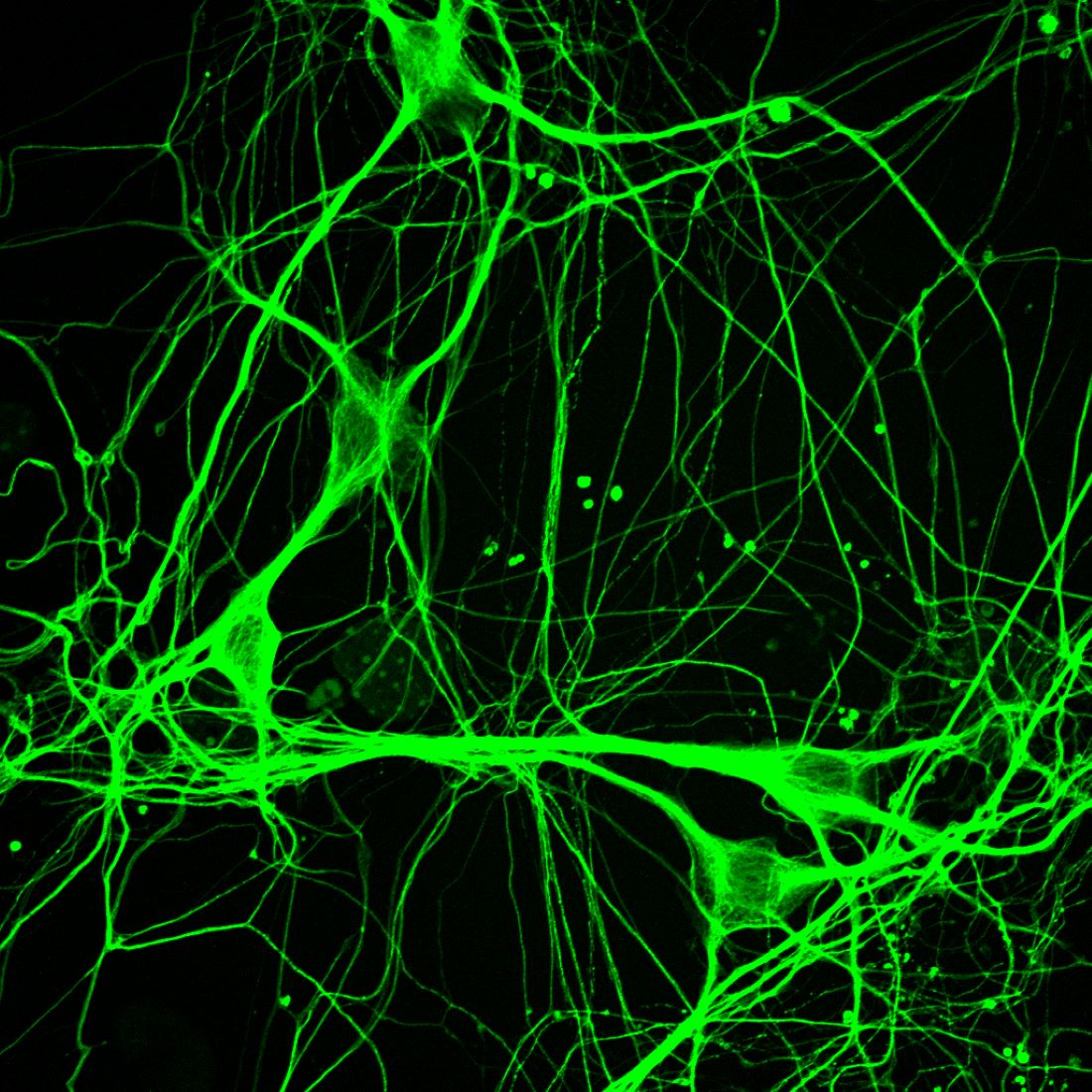 Hit3-treated human amyotrophic lateral sclerosis (ALS) neurons