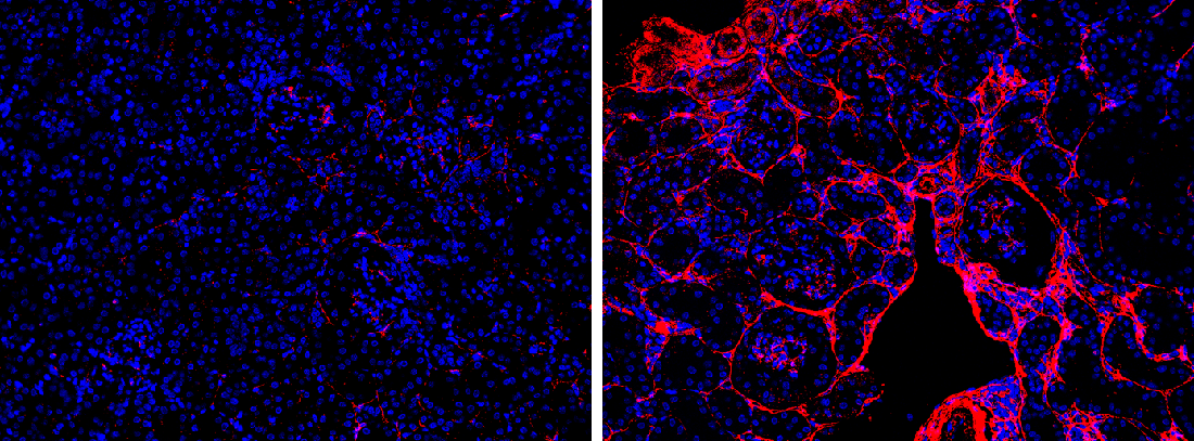 The image on the left shows a normal kidney, and the kidney on the right lacks the glucagon receptor. This scarring is visualized with a collagen III antibody shown at 20x magnification.