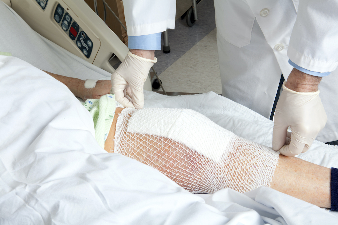 Knee replacement bandage