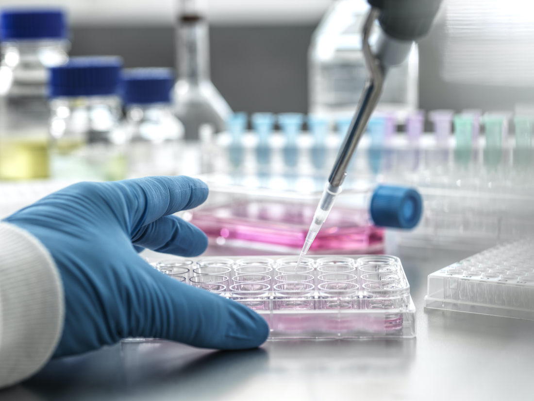 Scientist pipetting medical samples into microplate in laboratory