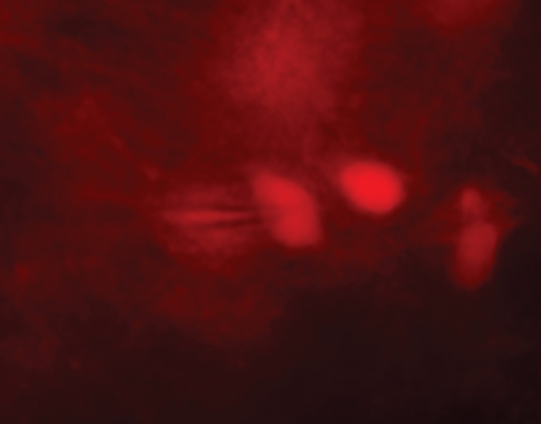 microscopic image shows mammalian cells with the Golgi apparatus