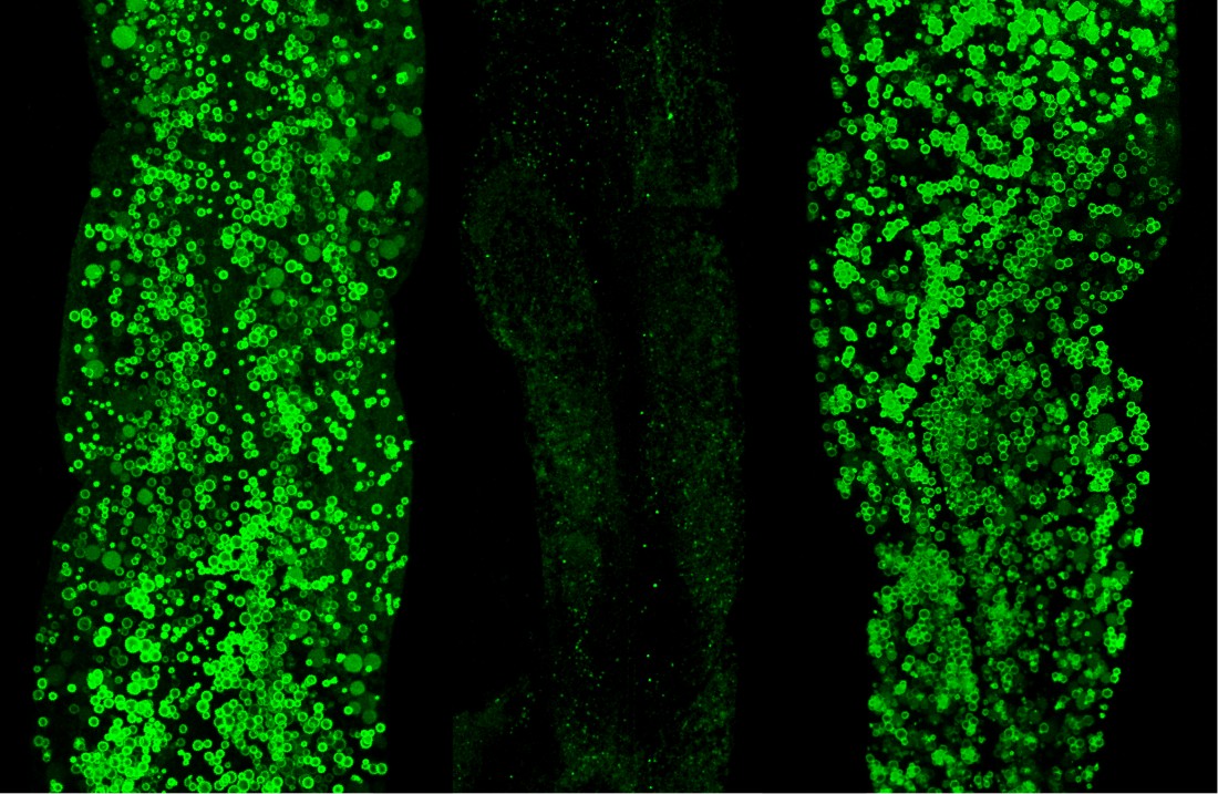 Images showing how three Caenorhabditis elegans roundworms use and restore fat (green) during feeding, fasting, and refeeding