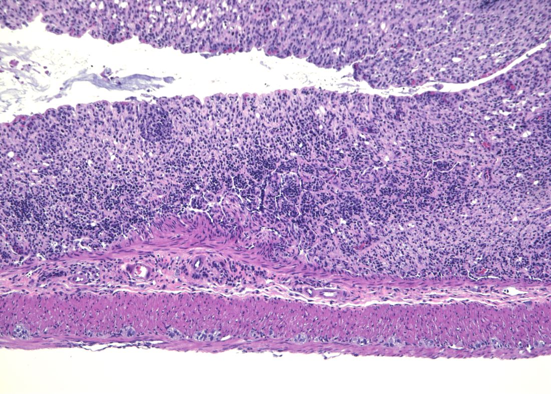 Colon tissue in mice lacking the ZBTB44 protein