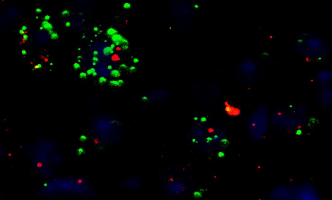 Neurons in a mouse paraventricular hypothalamus