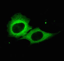 Cells fluorescing green