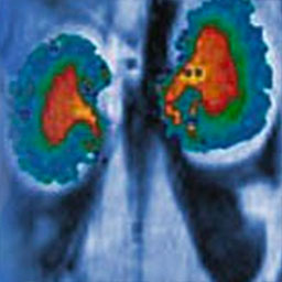 pH map of the kidneys of a mouse that shows colors of blue, green, red, orange, and yellow