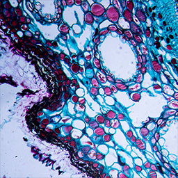 Microscopic cellular view of tissue sample with varying sized cells in shades of black, purple, and blue