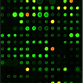 Autoantigen microarray