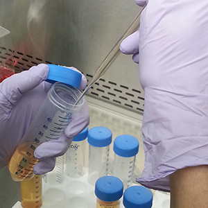 pipette extracting fluid from vial