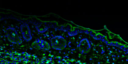 Digital image of cells