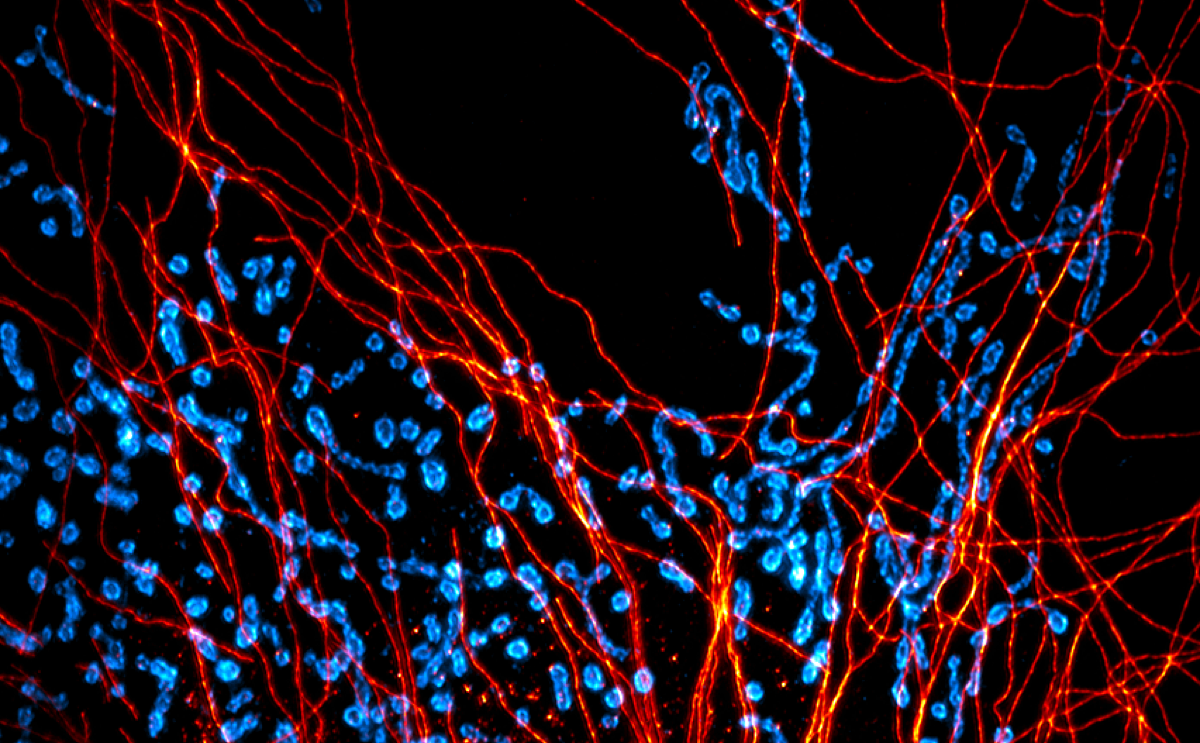 Representative fluorescence image with labeled cells and filament-like structures