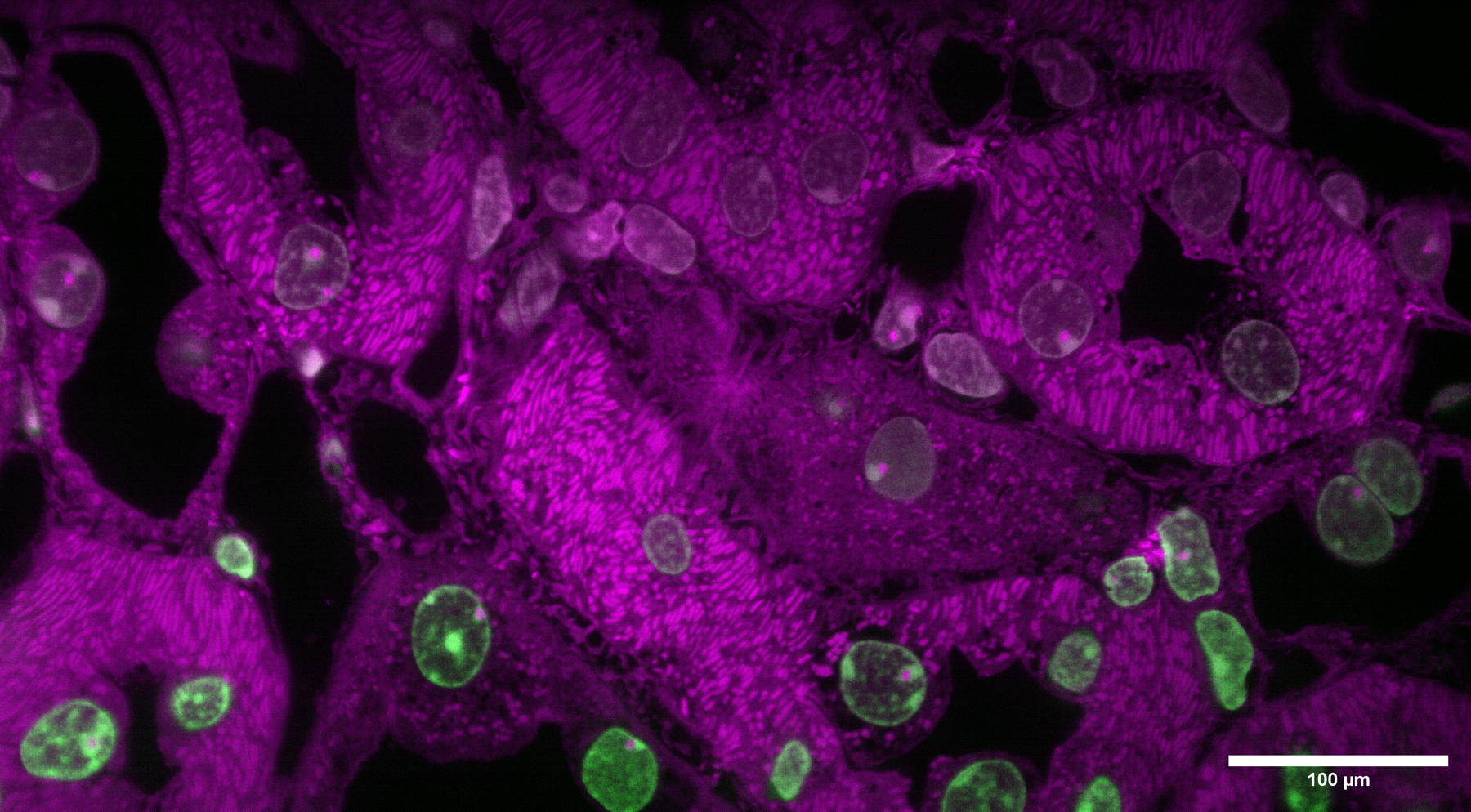 Representative tissue-scale fluorescence microscopy example with scale bar