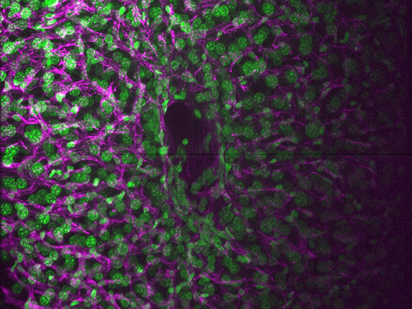 Expanded cleared liver vasculature image