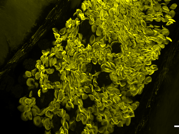 Expanded tissue vasculature image