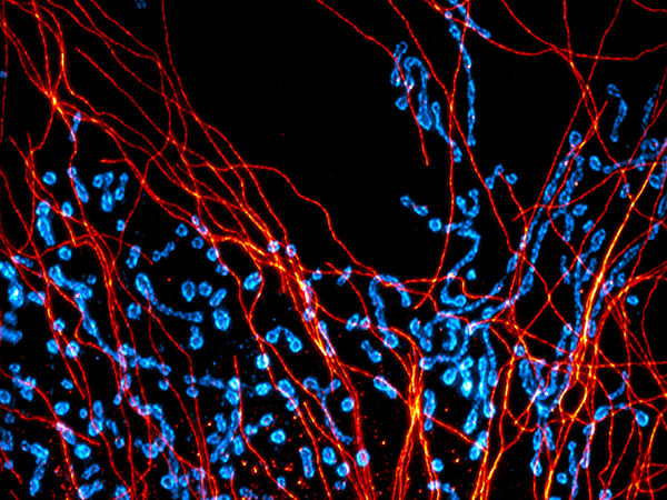 Expanded MEF microtubules mitochondria image