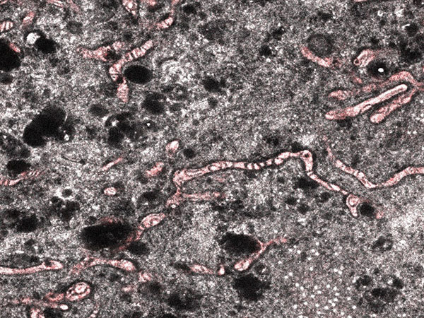 Expanded mitochondrial cristae.