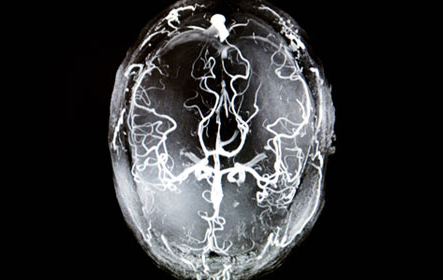 medical imaging of a brain